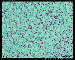 acid-fast stain, Ziehl-Neelsen stain of S.AUREUS